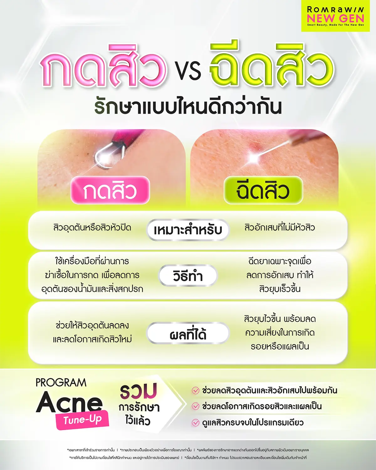 กดสิวใกล้ฉัน