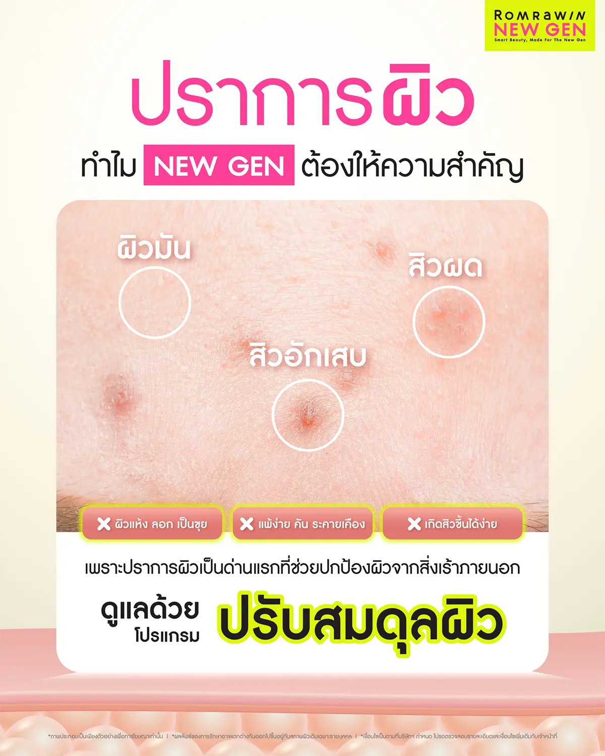 กดสิวใกล้ฉัน