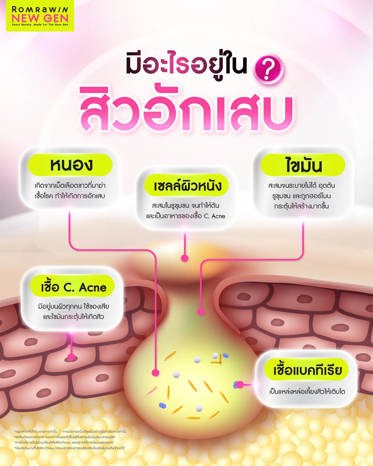 กดสิวใกล้ฉัน