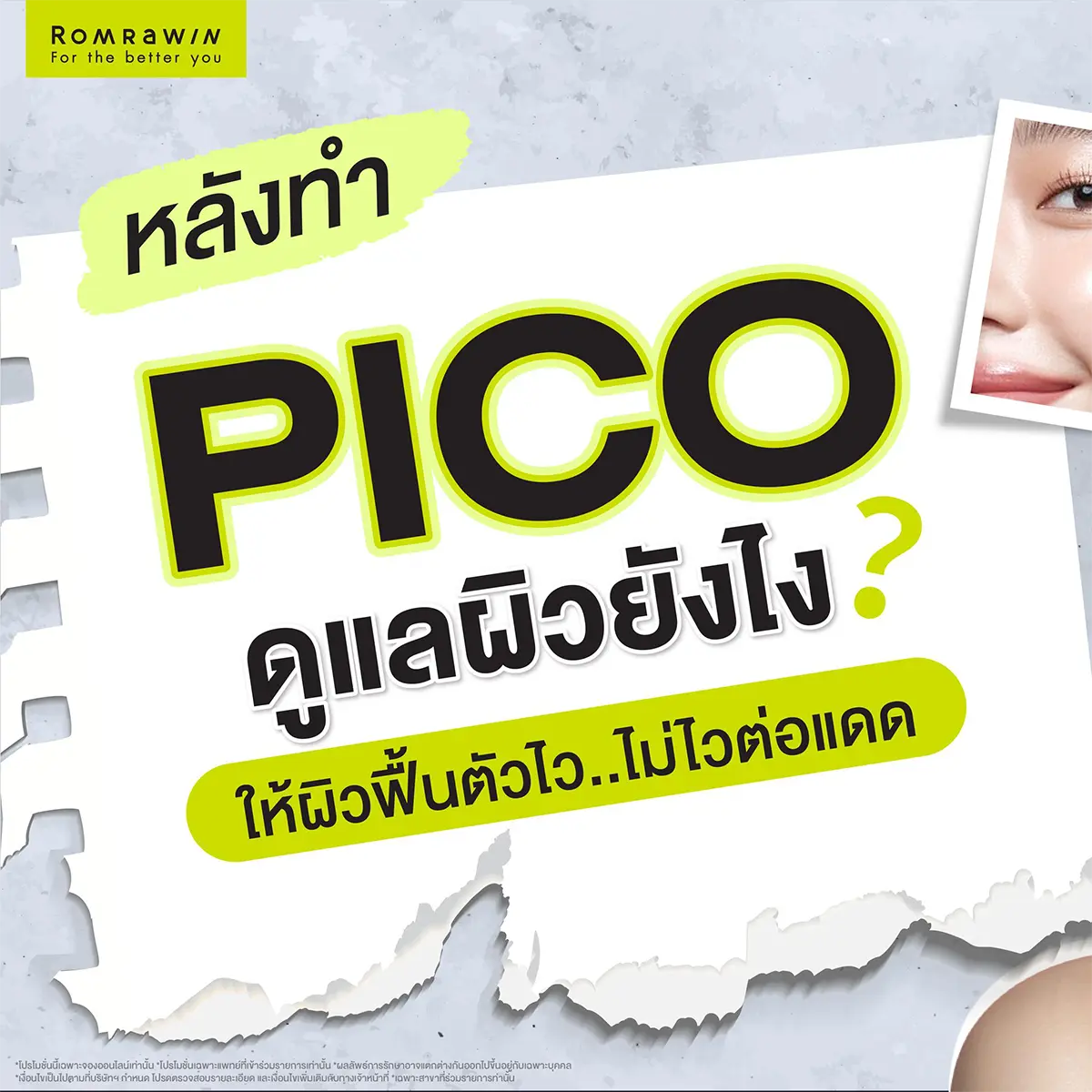 สิวฮอร์โมน