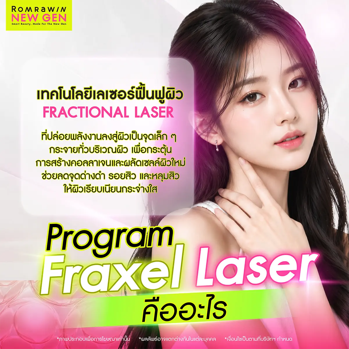 Fraxel Laser