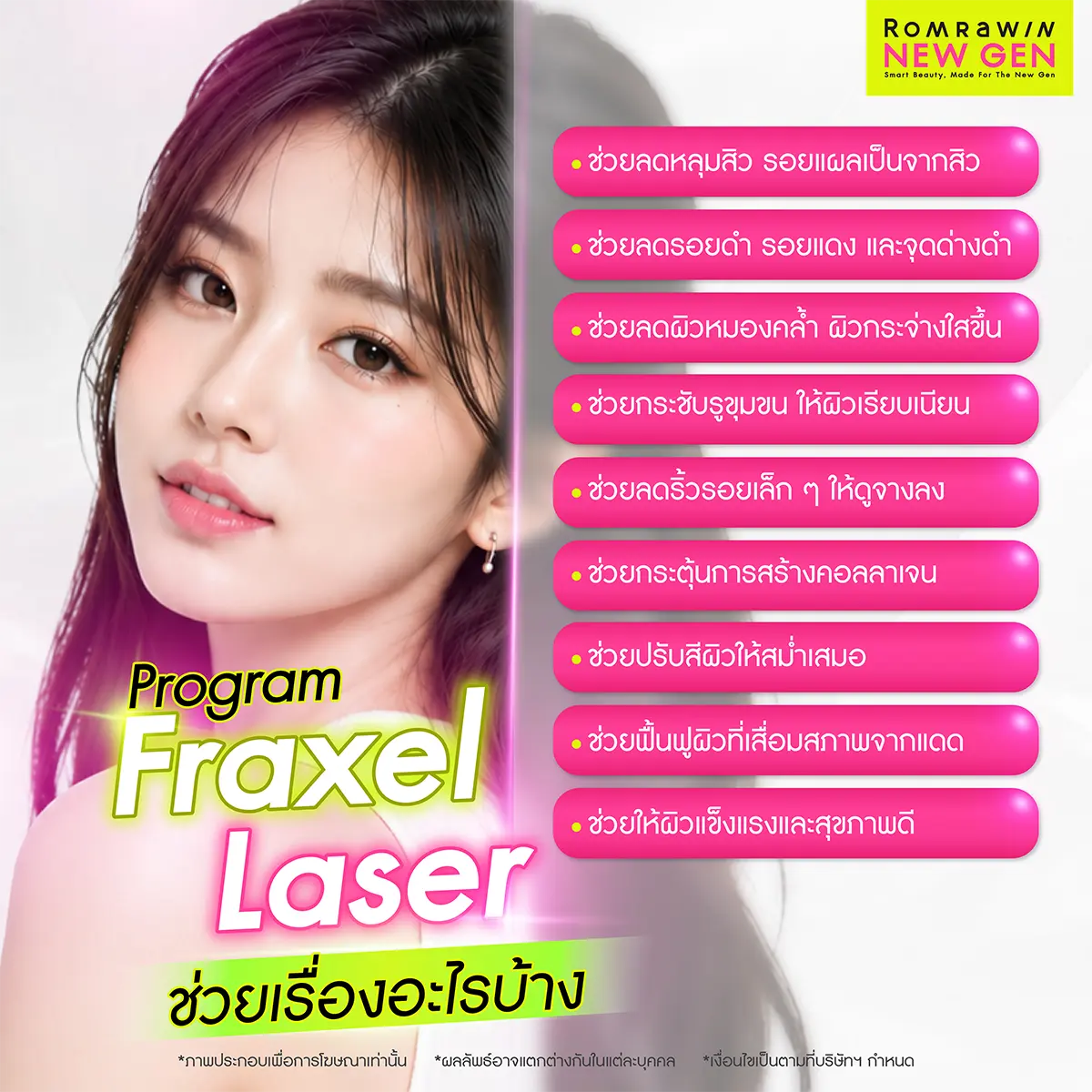 Fraxel Laser