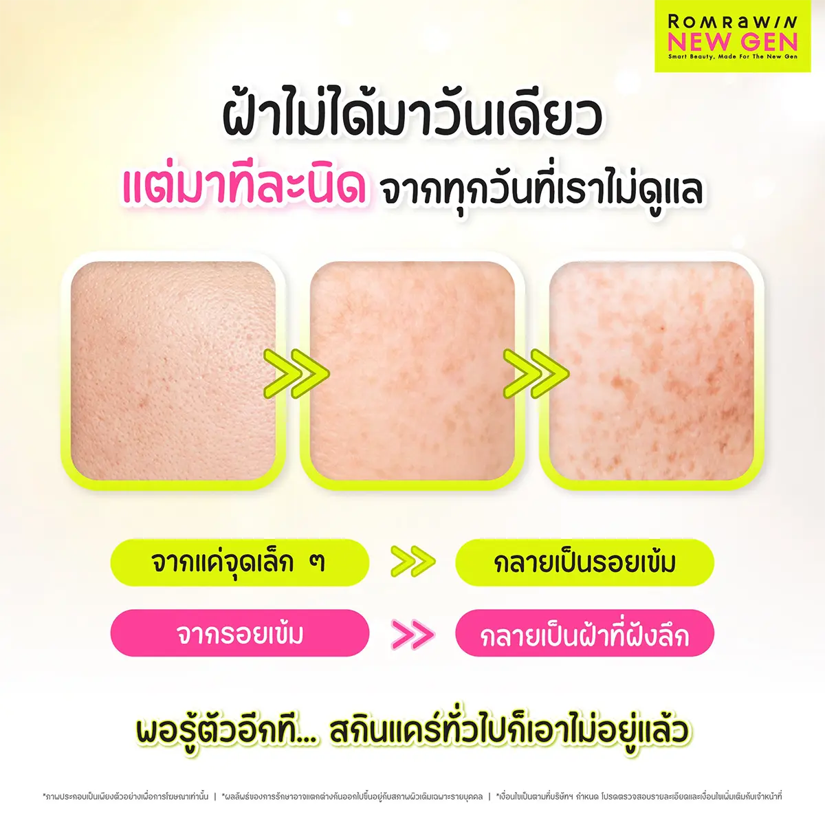 รักษาฝ้า