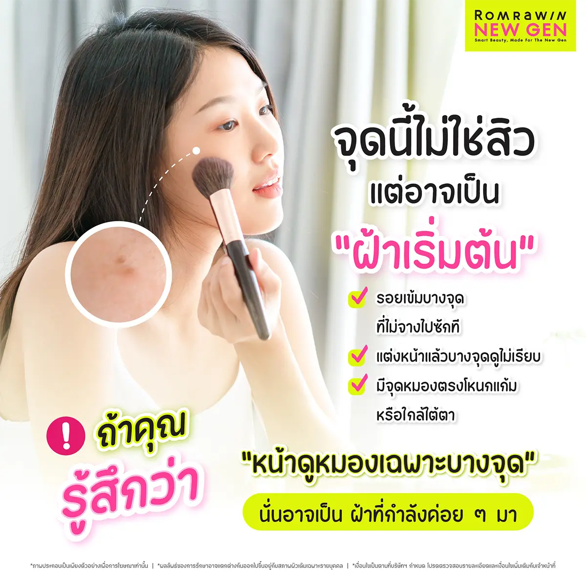 รักษาฝ้า