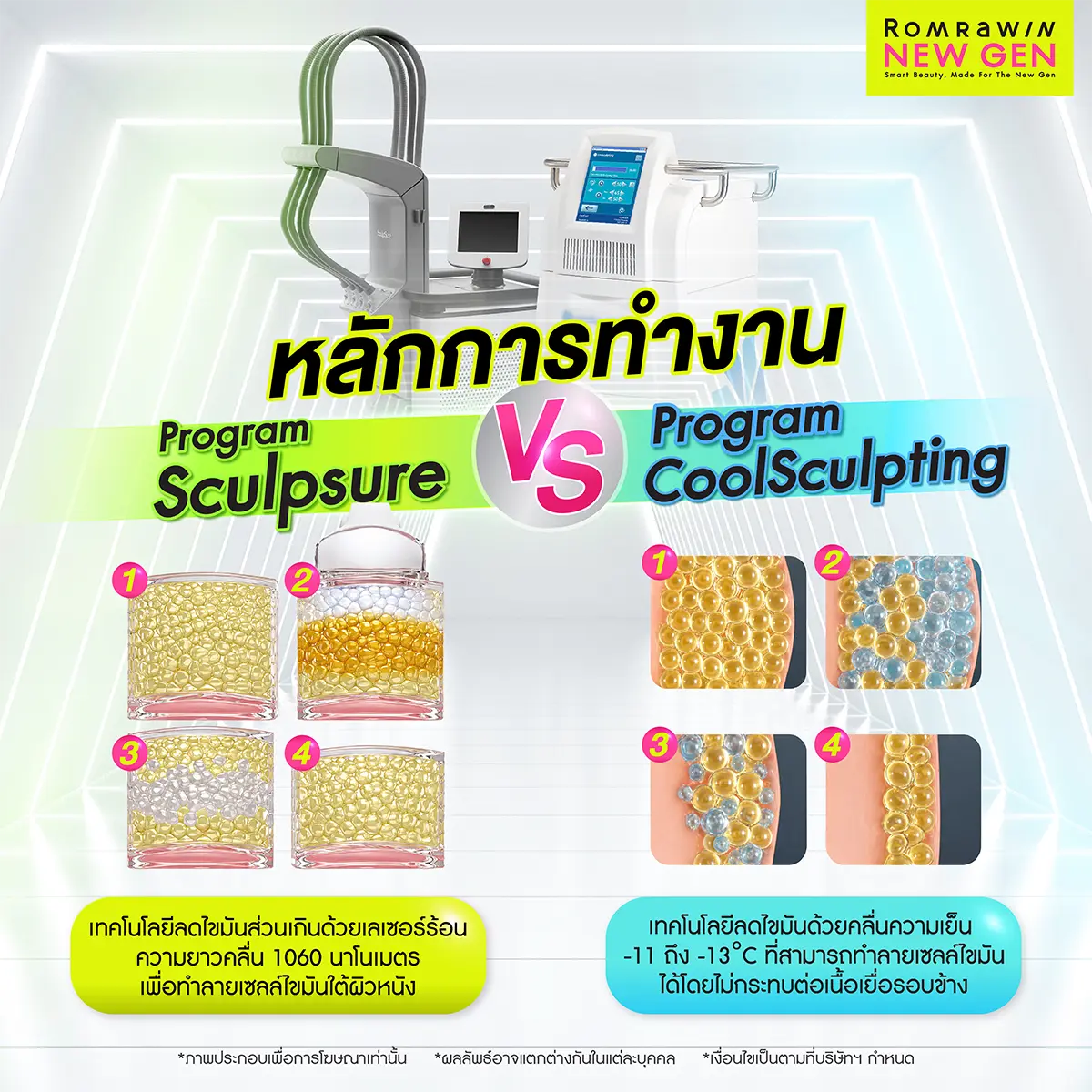Sculpsure กับ Coolsculpting