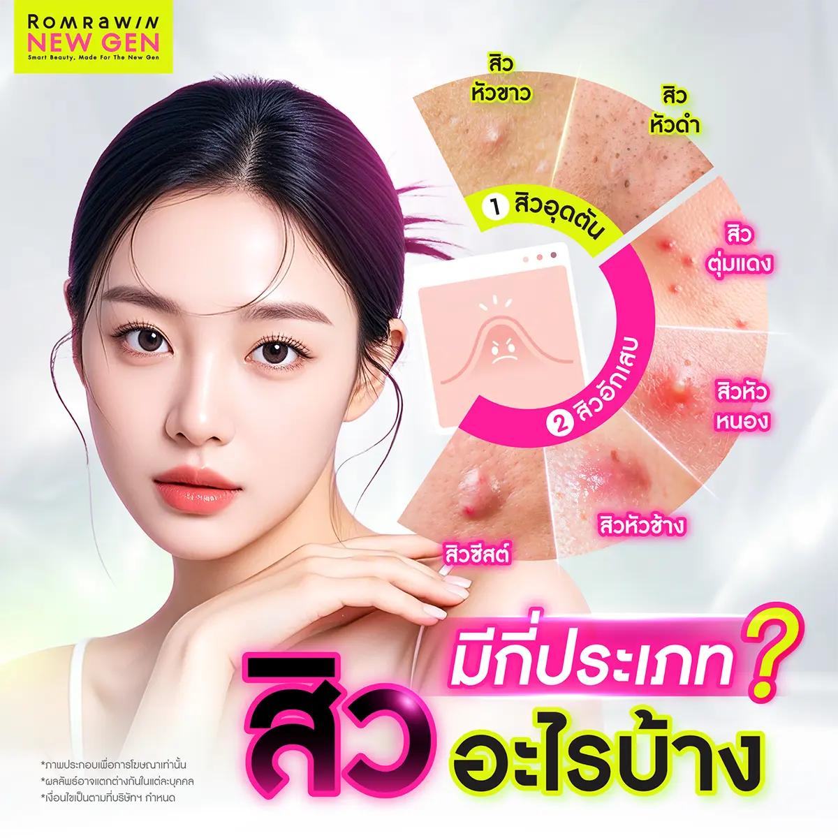 กดสิวใกล้ฉัน