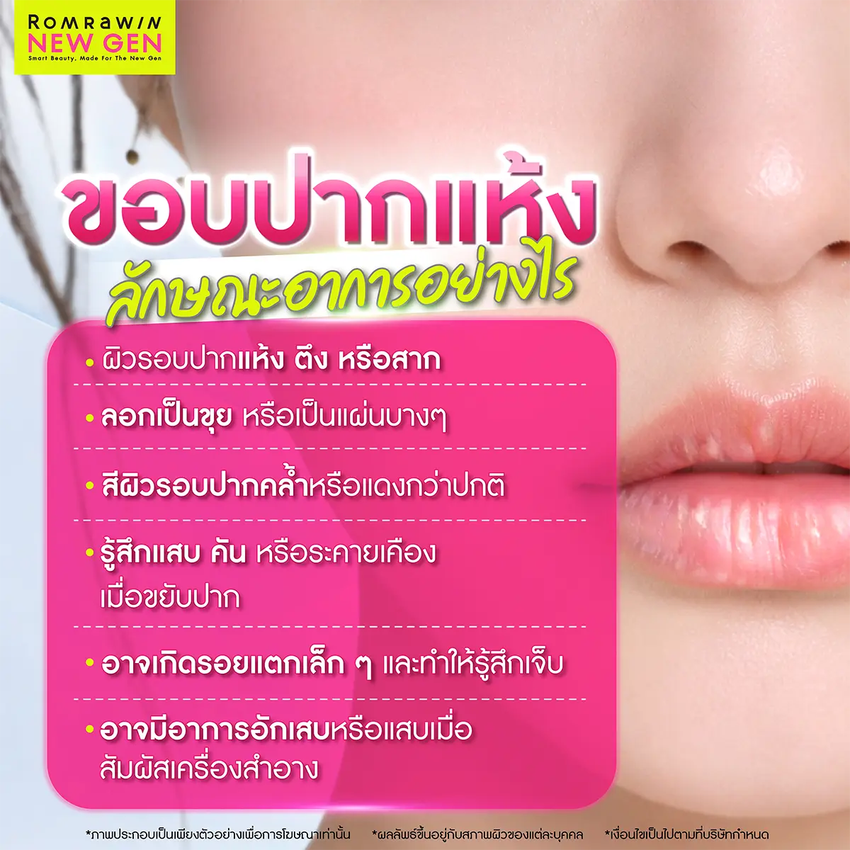ขอบปากแห้ง