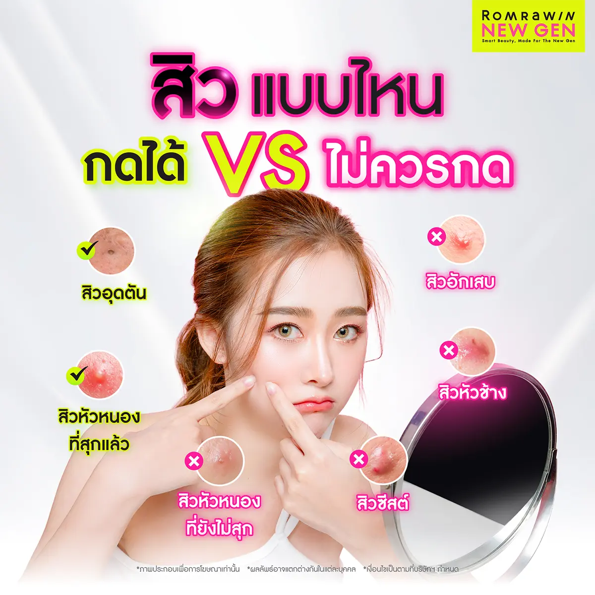 กดสิวใกล้ฉัน