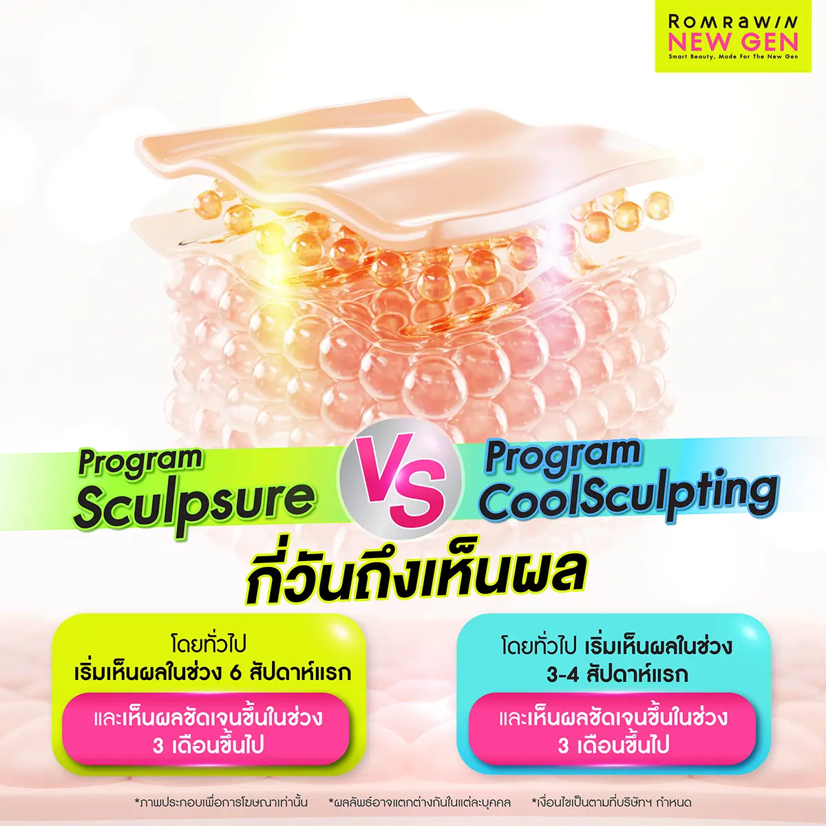 Sculpsure กับ Coolsculpting