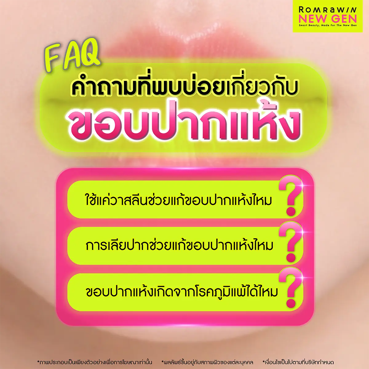 ขอบปากแห้ง