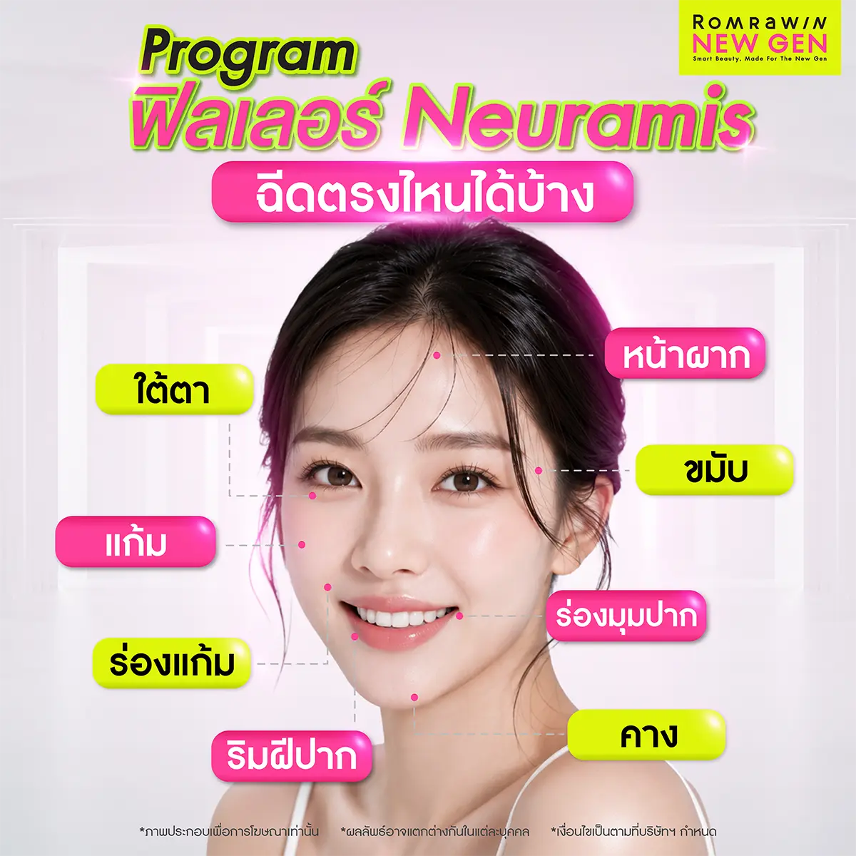 ฟิลเลอร์ Neuramis