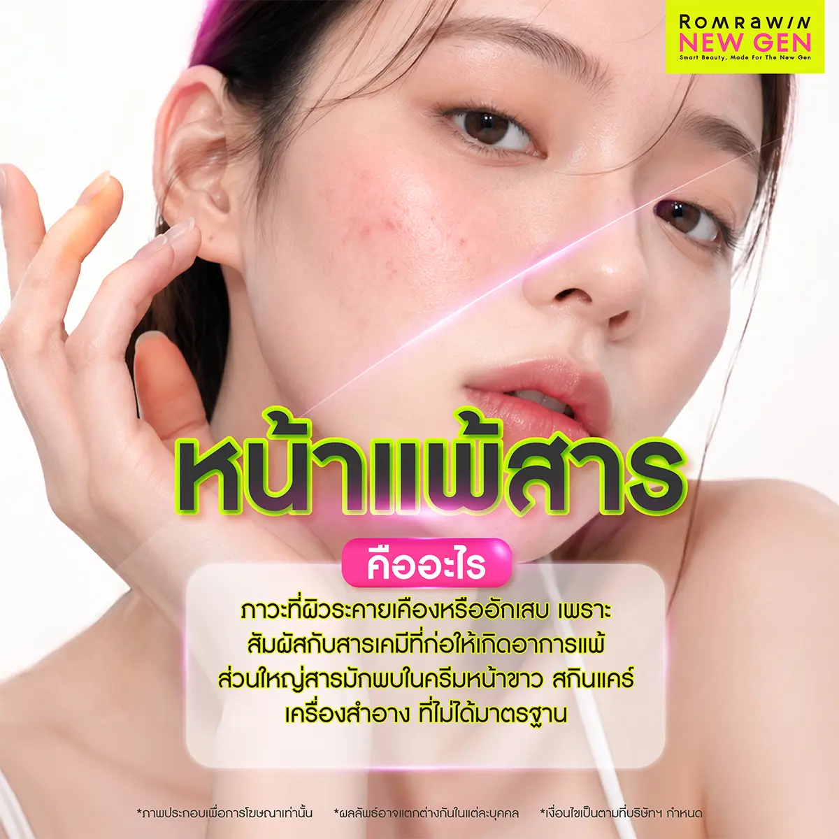 หน้าแพ้สาร