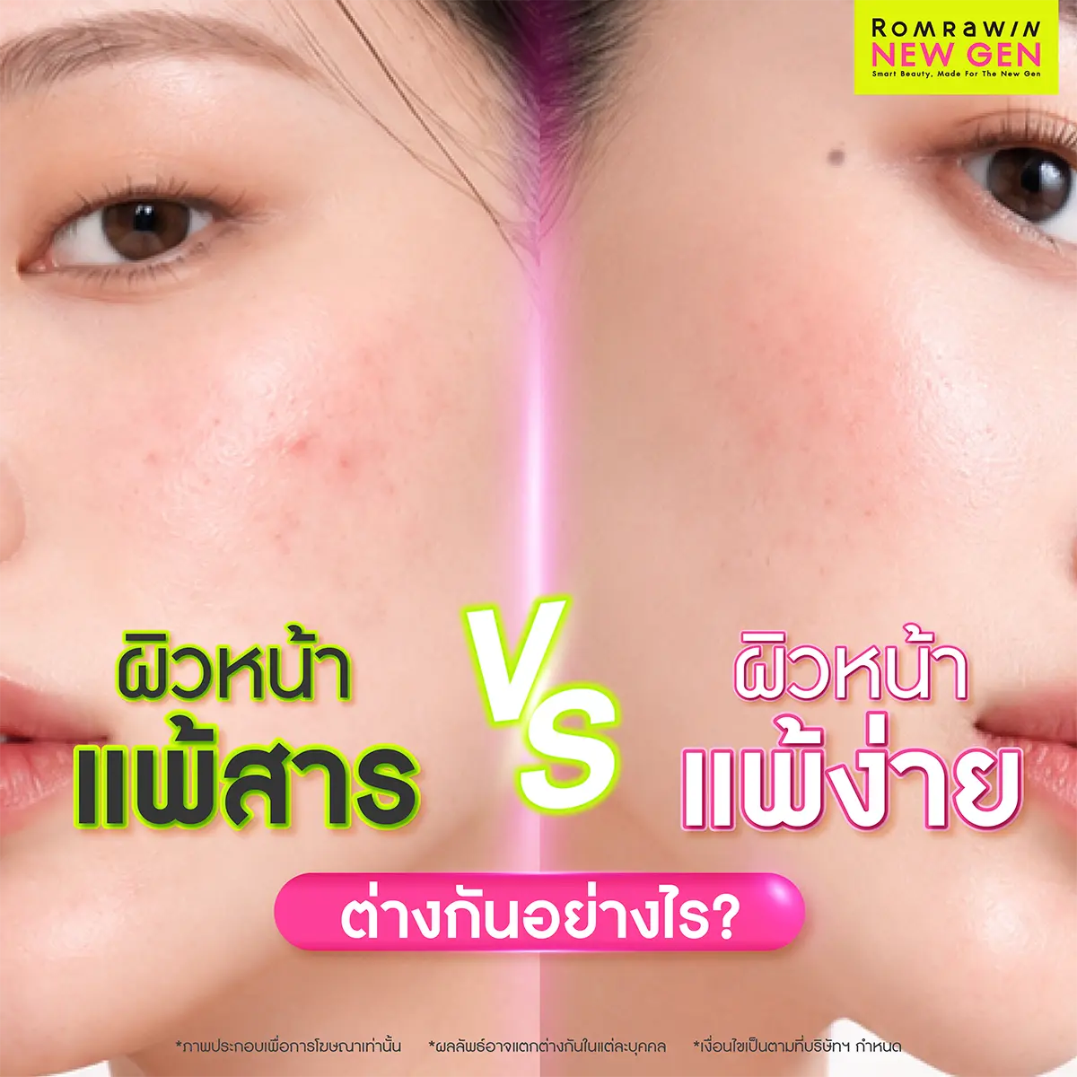 ผิวหน้าแพ้สาร vs ผิวหน้าแพ้ง่าย