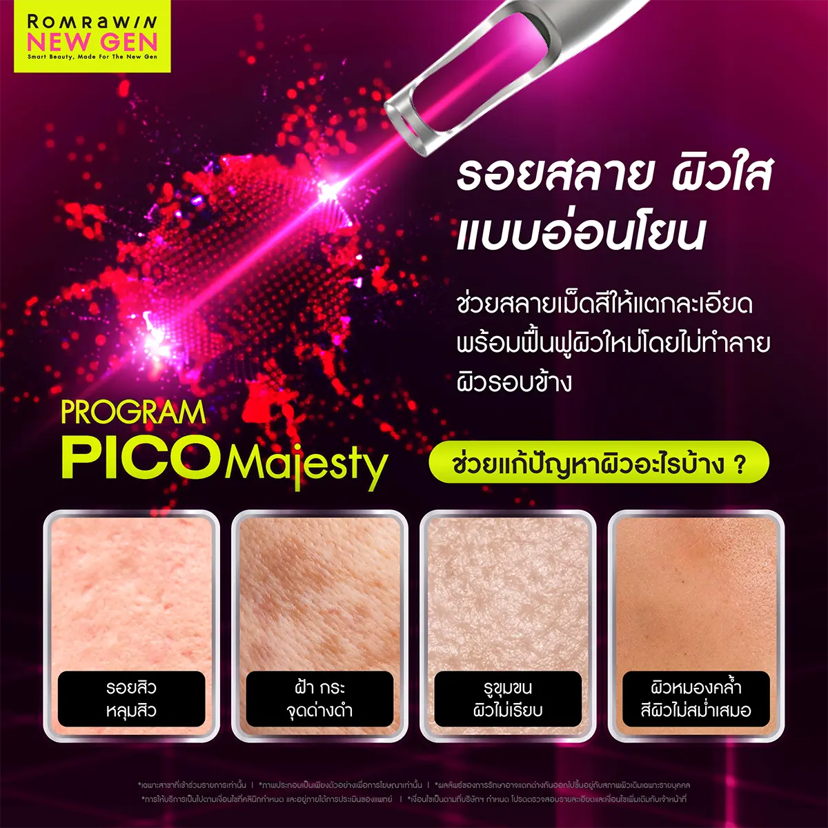 ชวนเช็กปัญหาสภาพผิวหน้าสารพัดรูปแบบที่สามารถแก้ไขได้ด้วยโปรแกรม Pico Majesty รมย์รวินท์คลินิก
