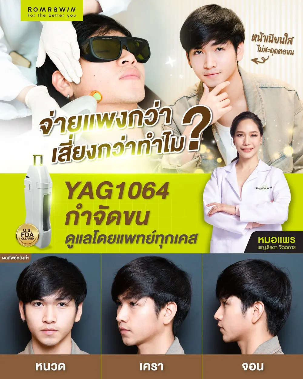 รีวิวเลเซอร์หนวด