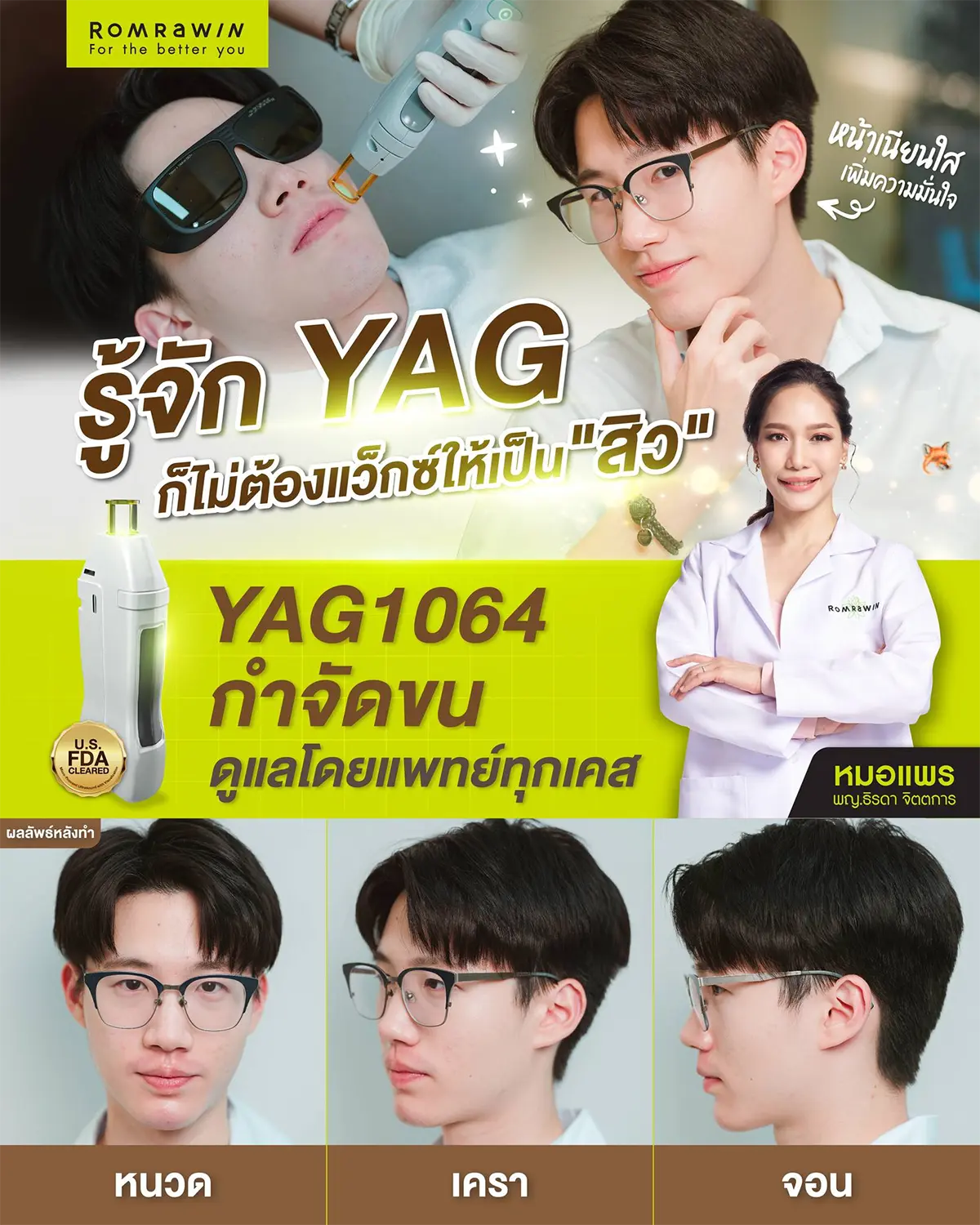 รีวิวเลเซอร์หนวด