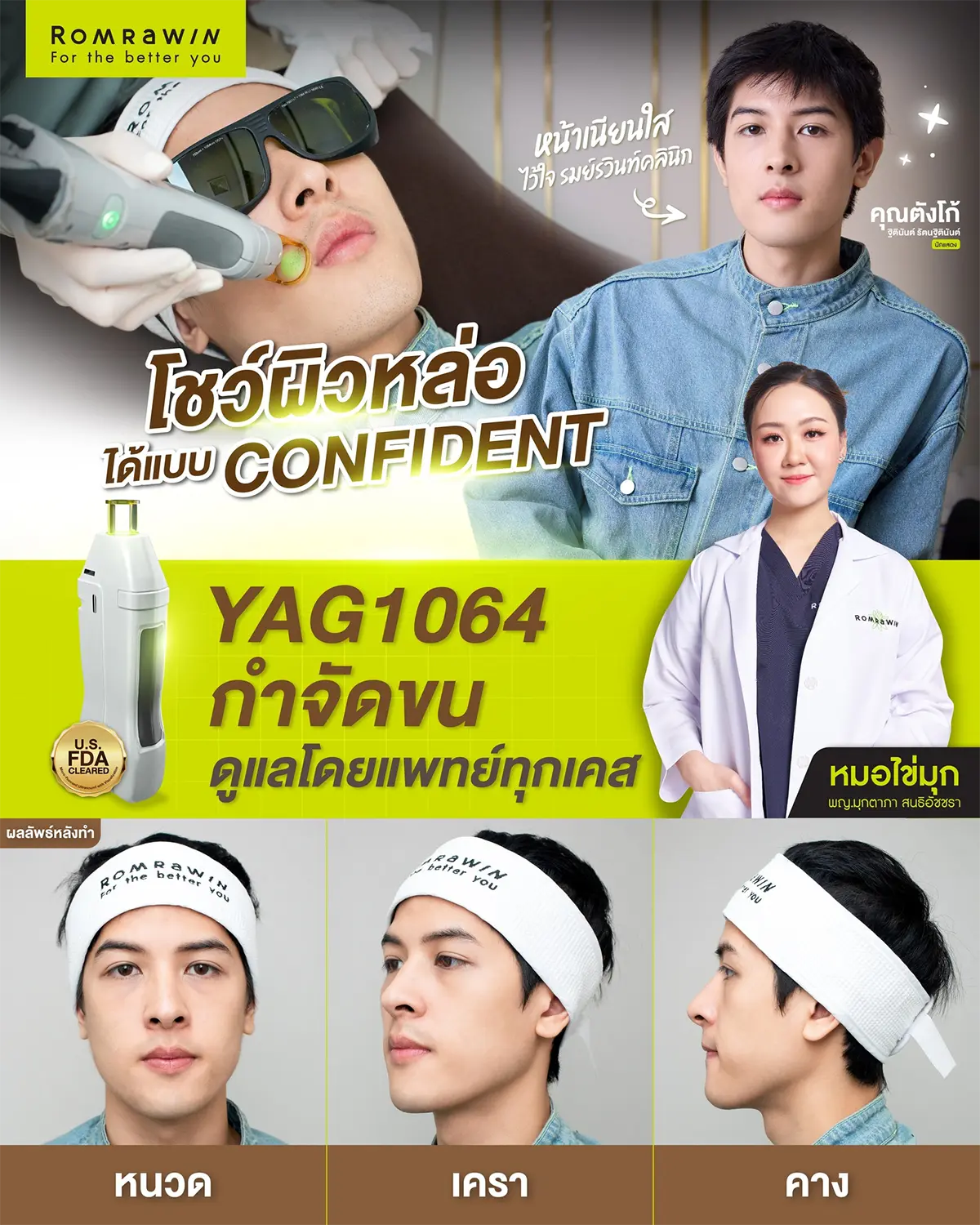 รีวิวเลเซอร์หนวด