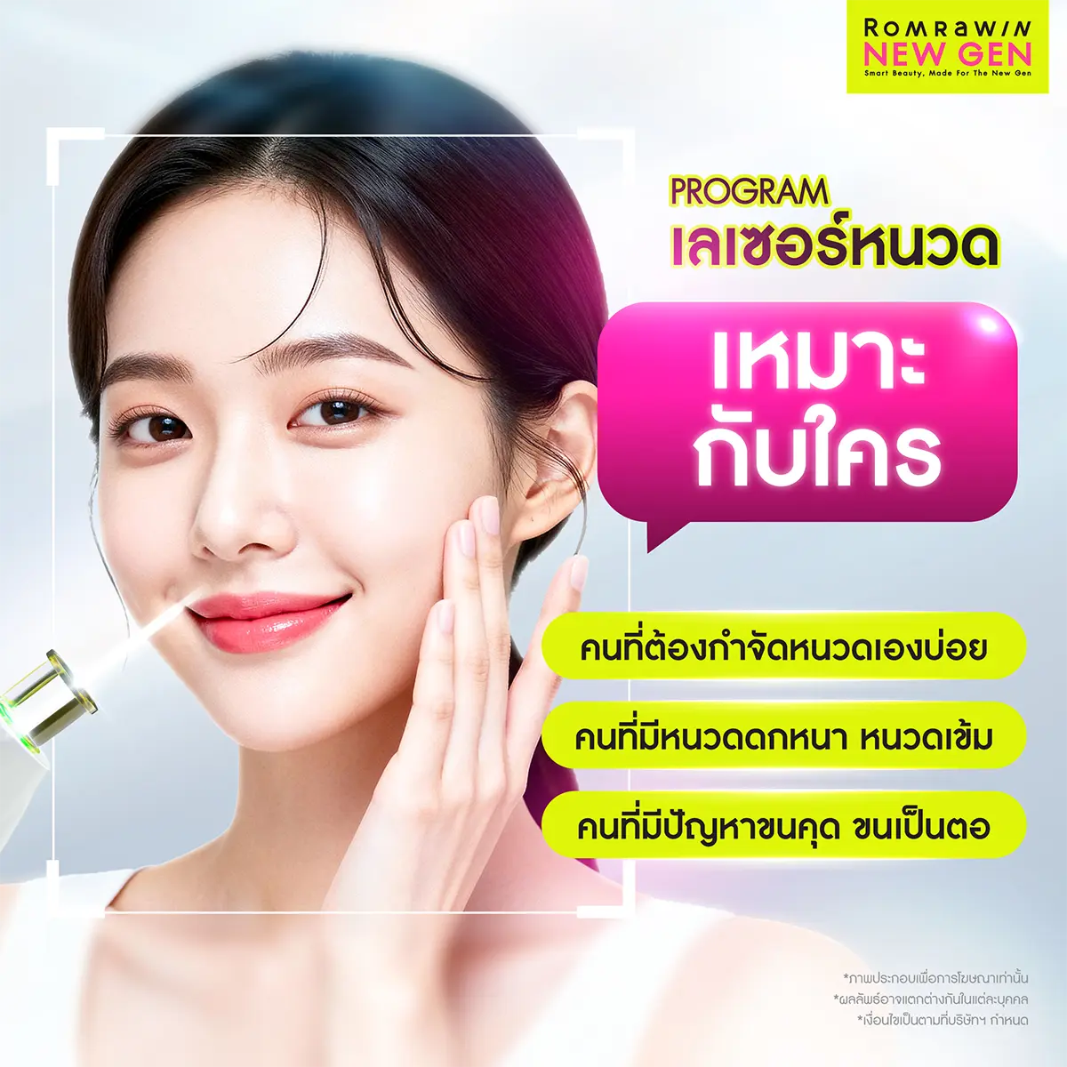 เลเซอร์หนวด