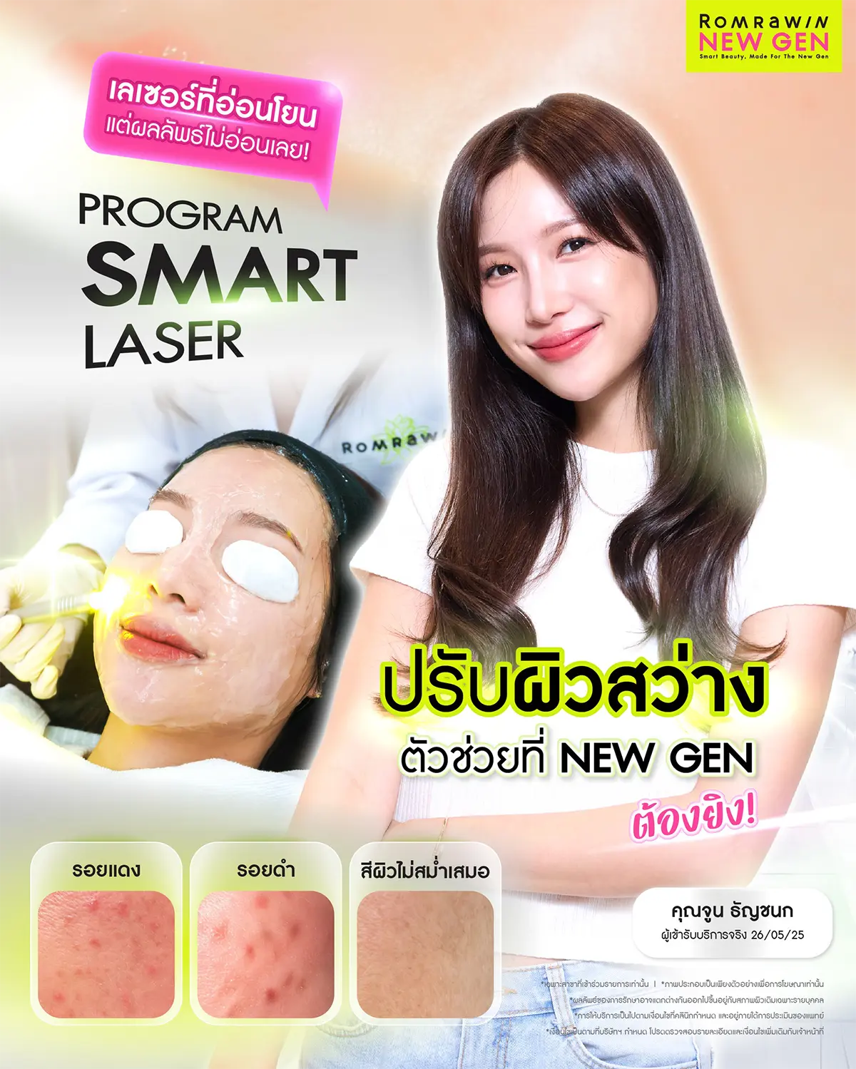 รักษาสิว