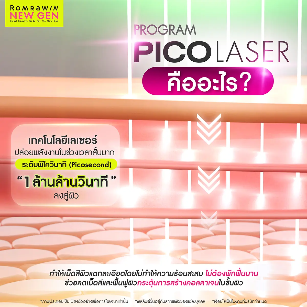 Pico Laser คืออะไร