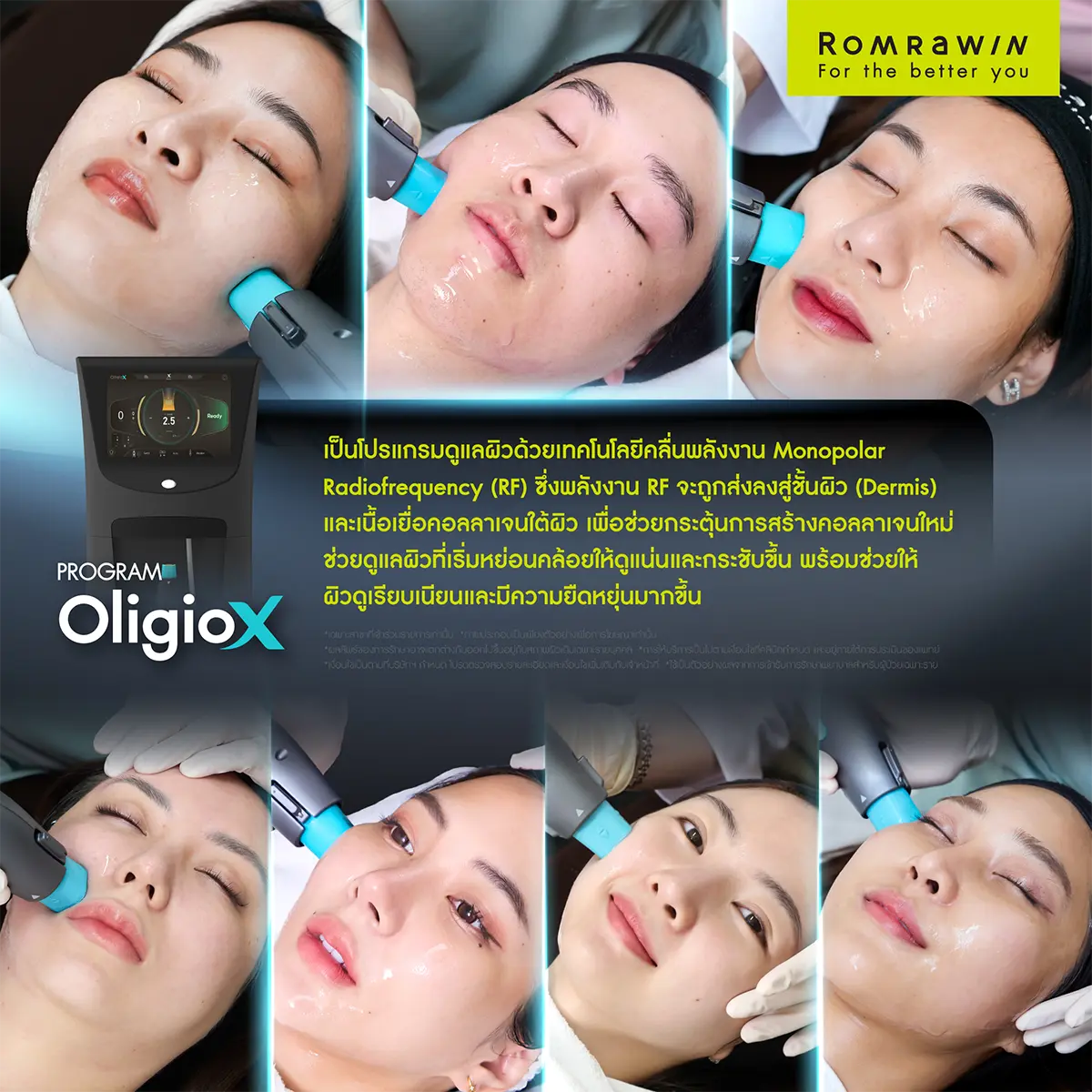 รีวิว Oligio X จากผู้ใช้บริการจริง