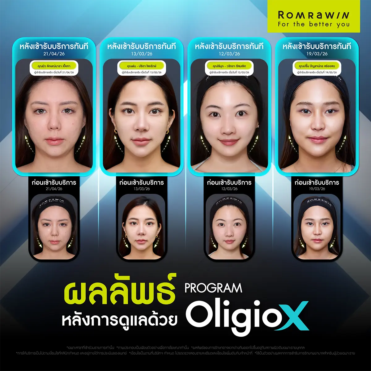 รีวิว Oligio X จากผู้ใช้บริการจริง