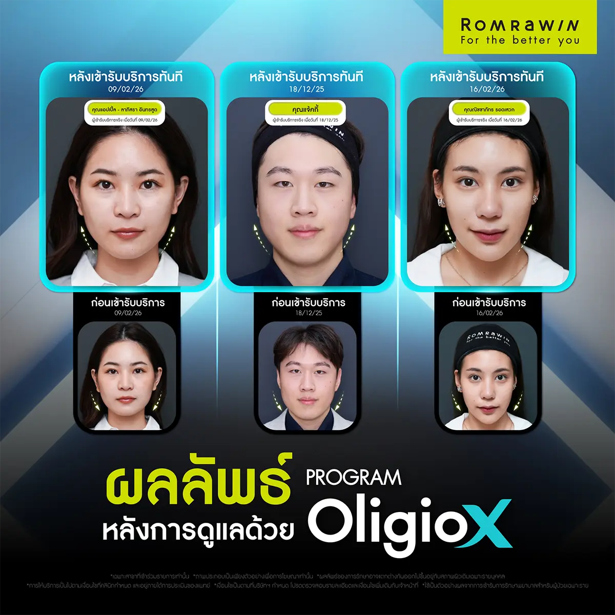 รีวิว Oligio X จากผู้ใช้บริการจริง