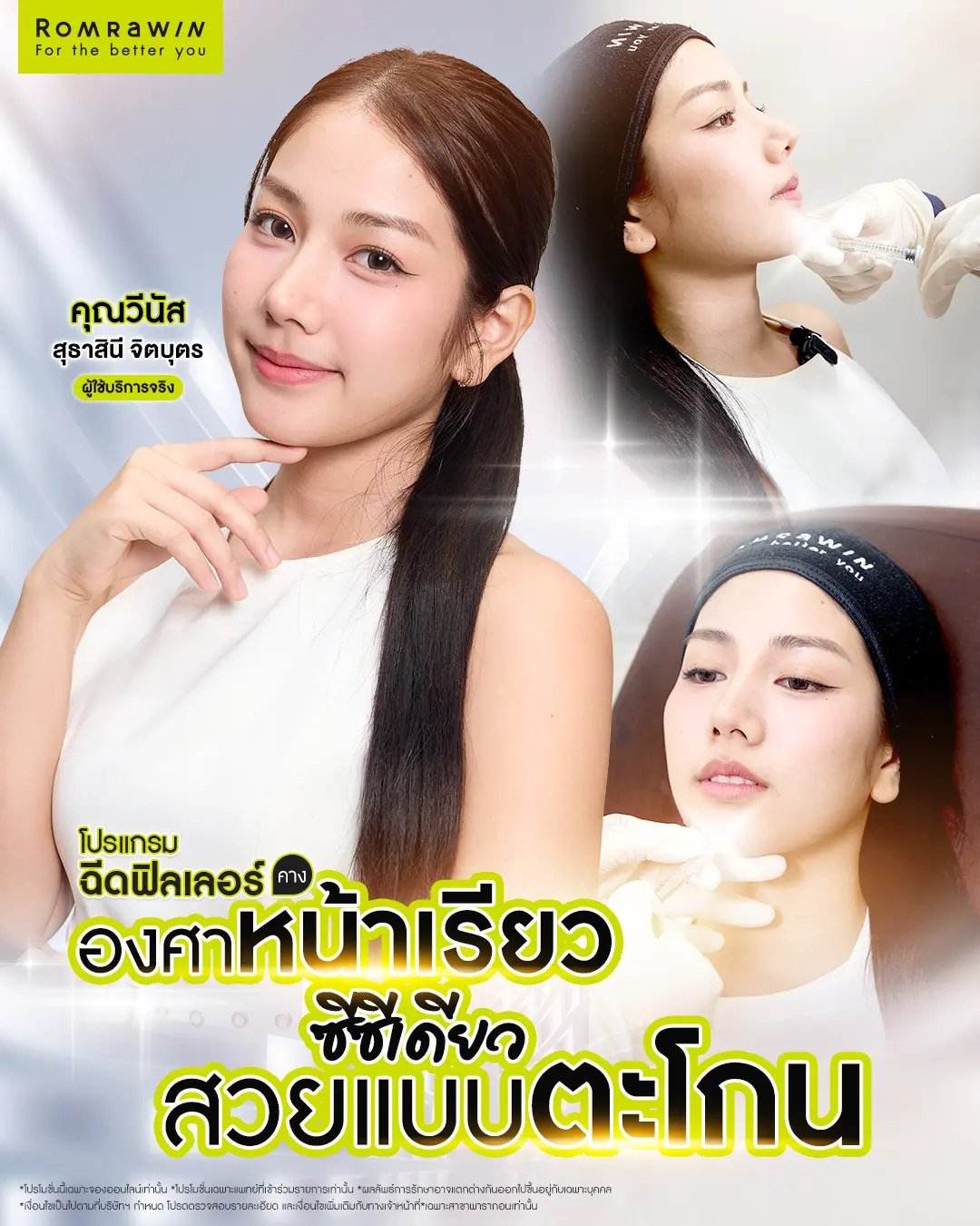 รีวิวฉีดฟิลเลอร์