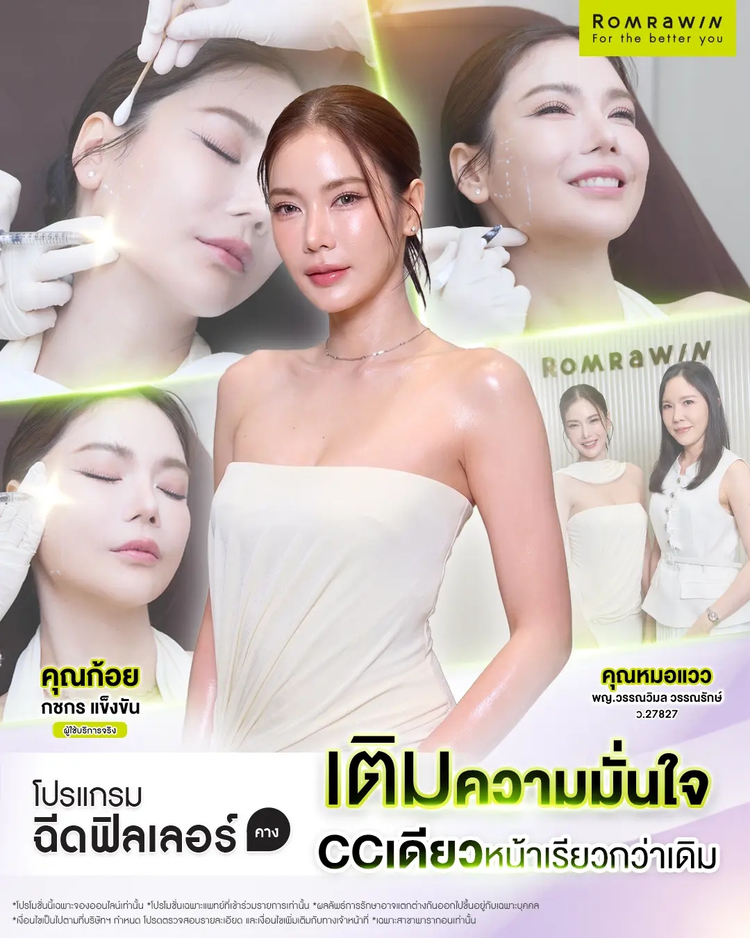 รีวิวฉีดฟิลเลอร์
