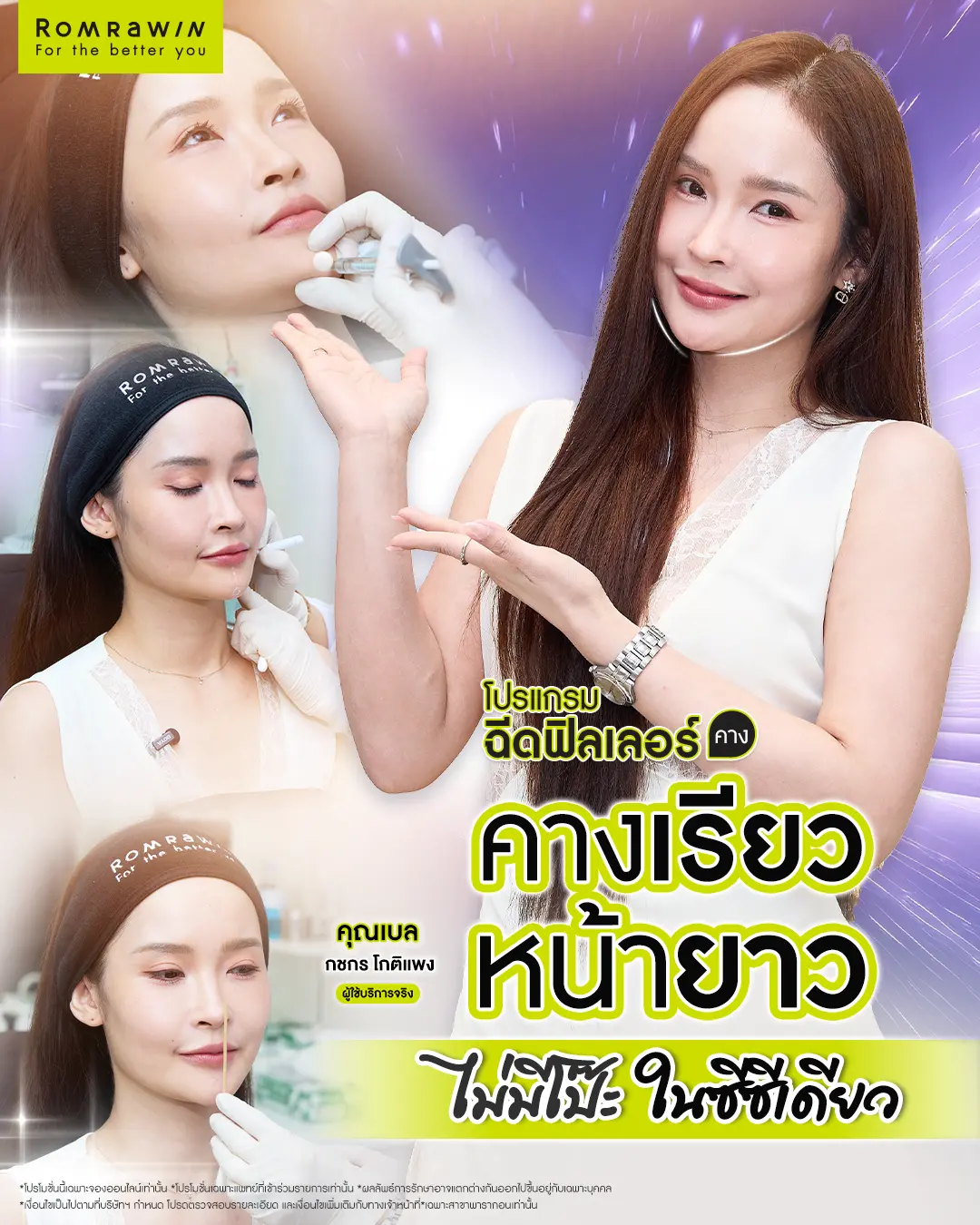 รีวิวฉีดฟิลเลอร์