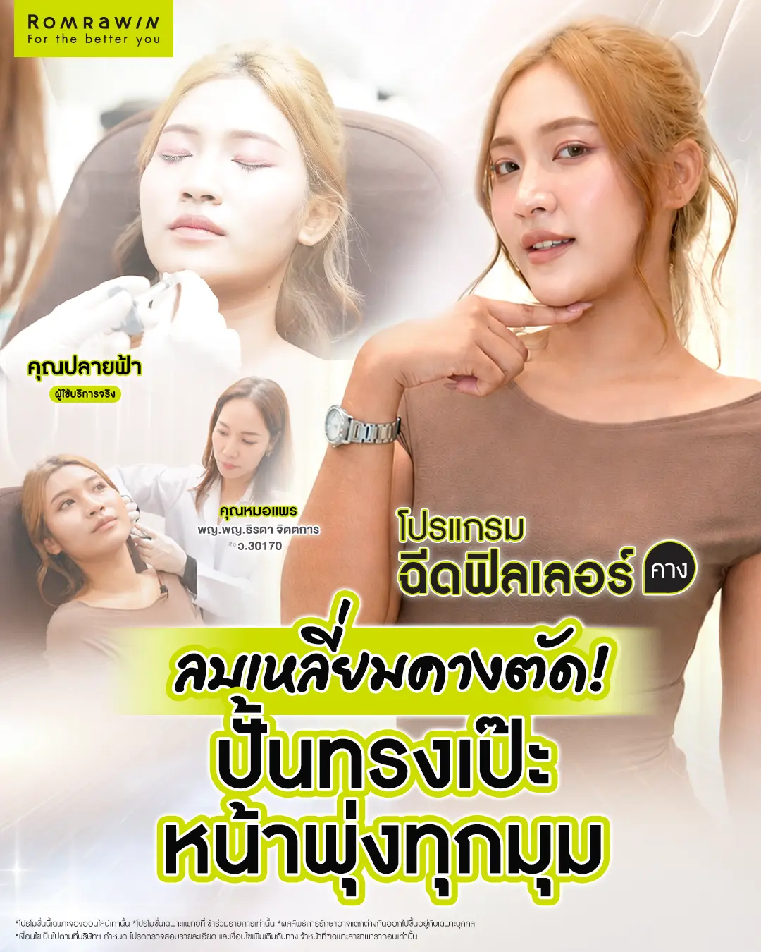 รีวิวฉีดฟิลเลอร์