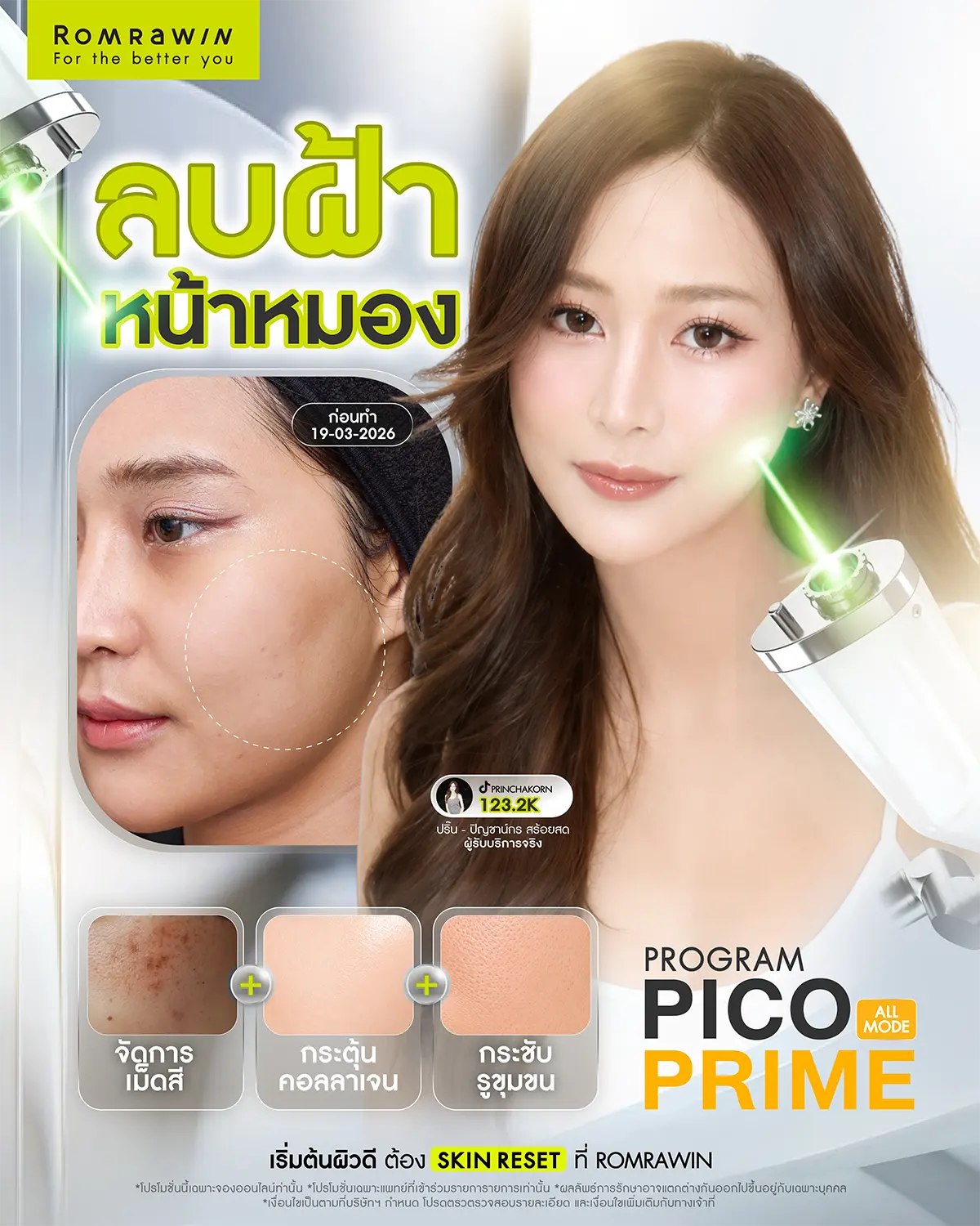 รีวิว pico prime