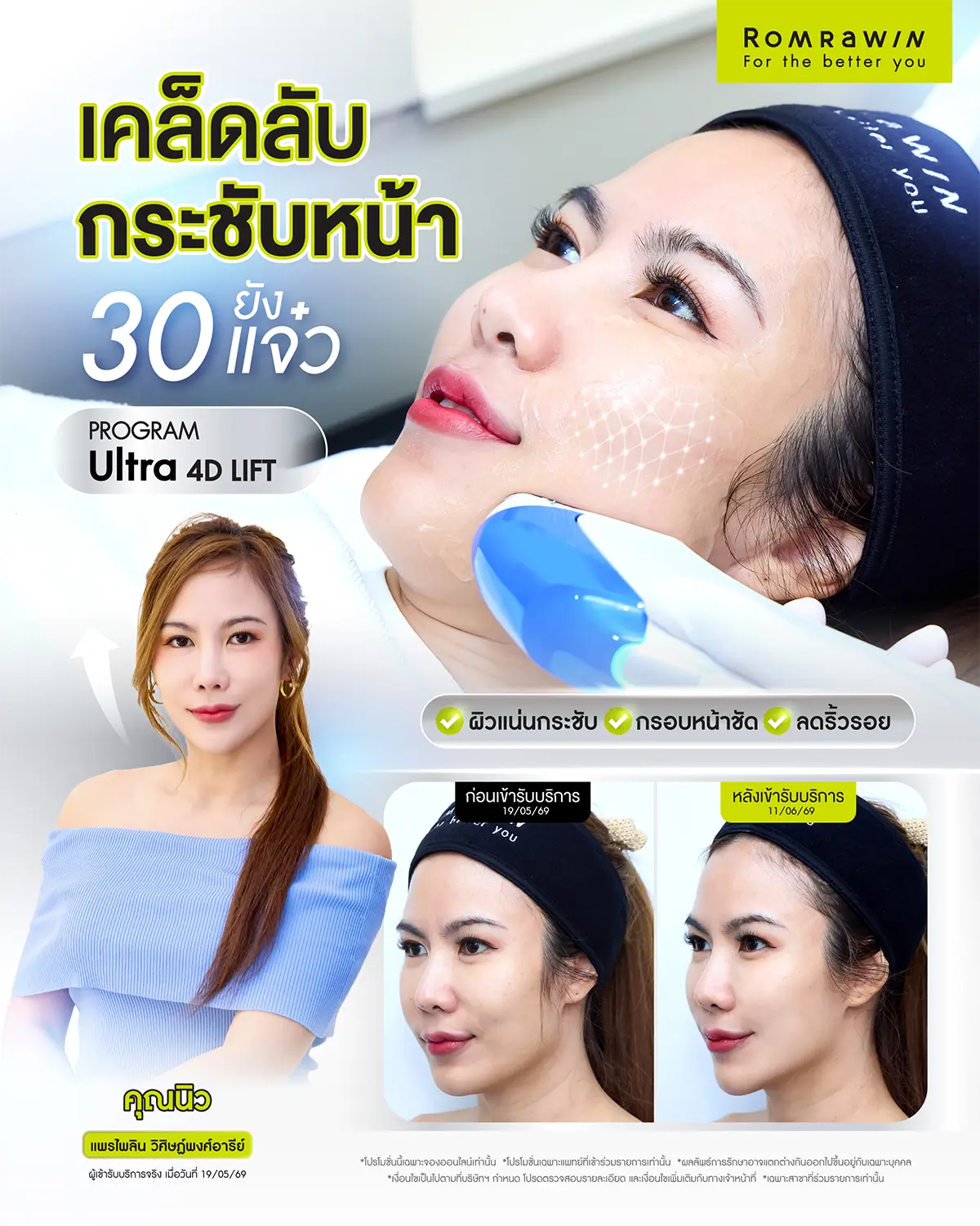 รีวิว Ultraformer MPT