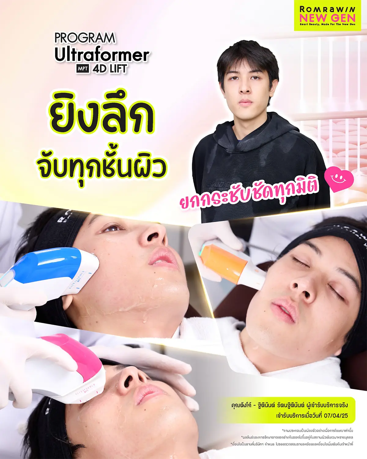 รีวิว Ultraformer MPT