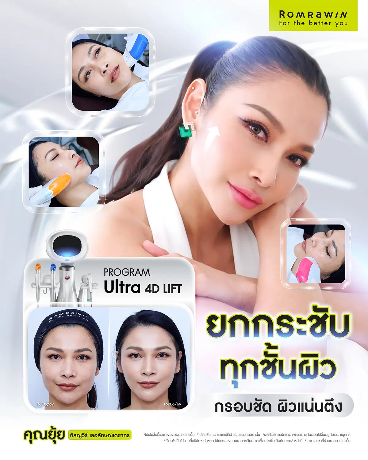 รีวิว Ultraformer MPT