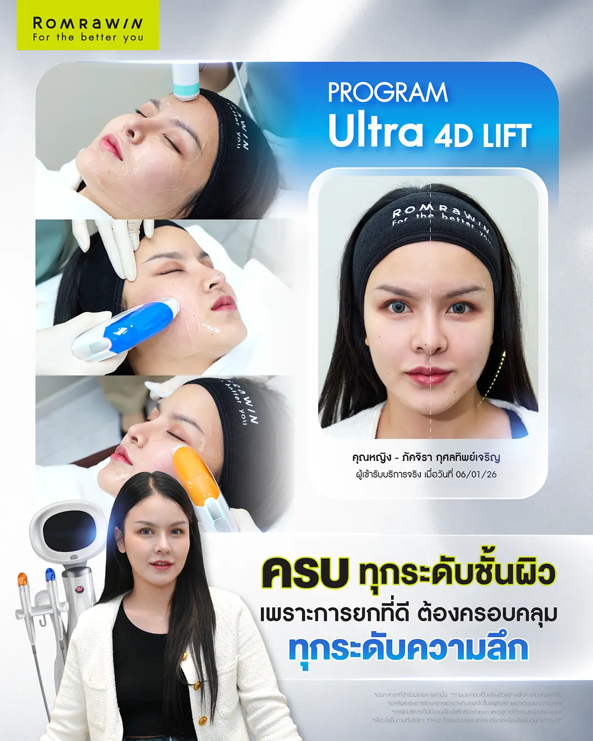 รีวิว Ultraformer MPT