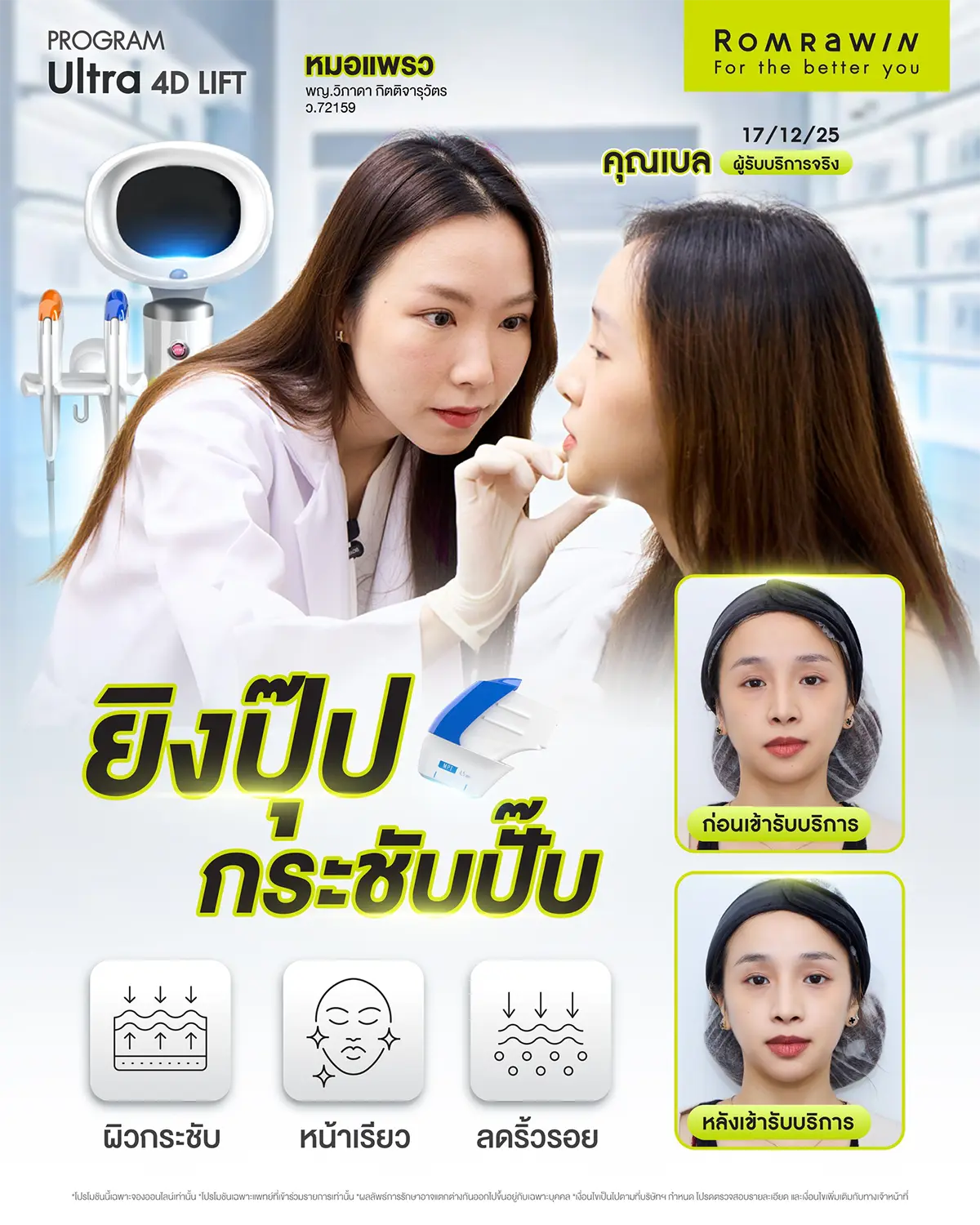 รีวิว Ultraformer MPT