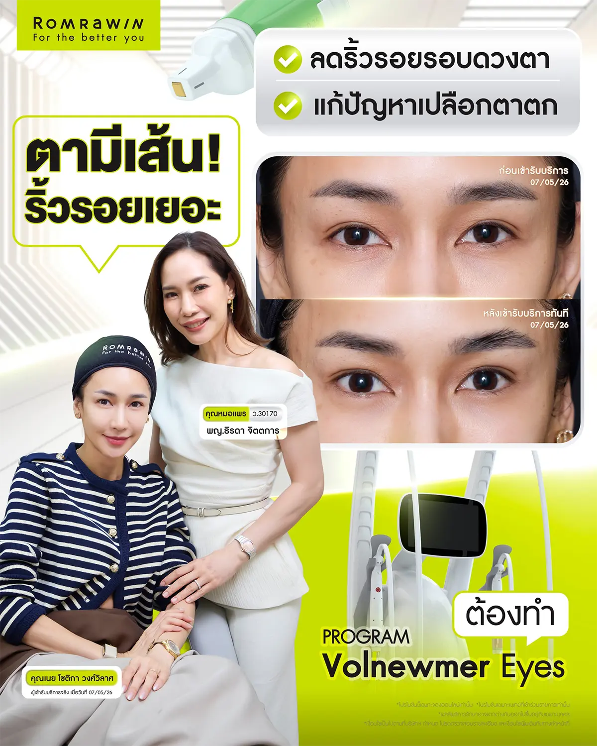 รีวิว Volnewmer