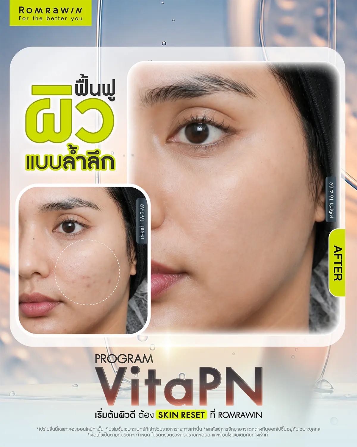 รีวิว Vitaran