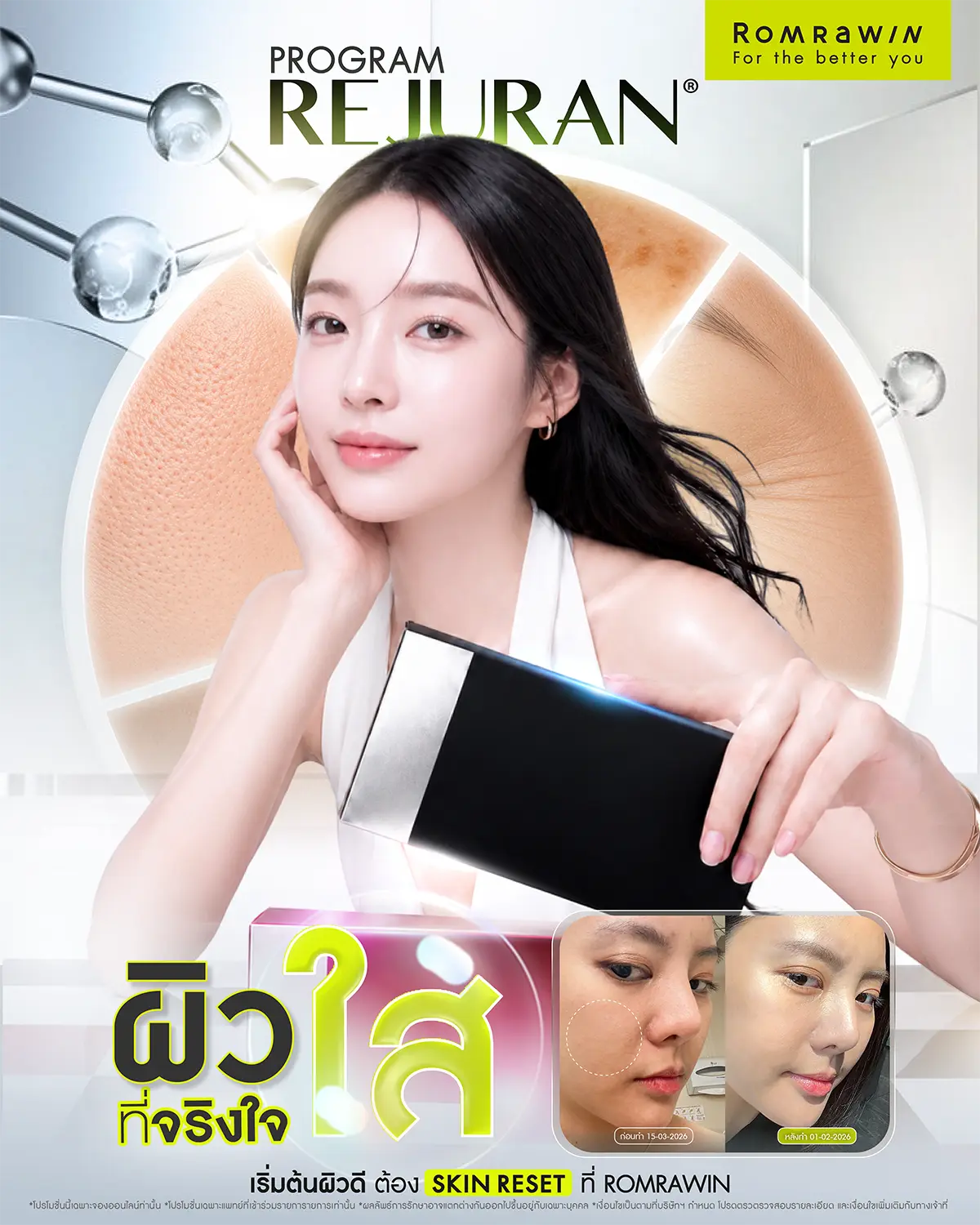 รีวิว Rejuran