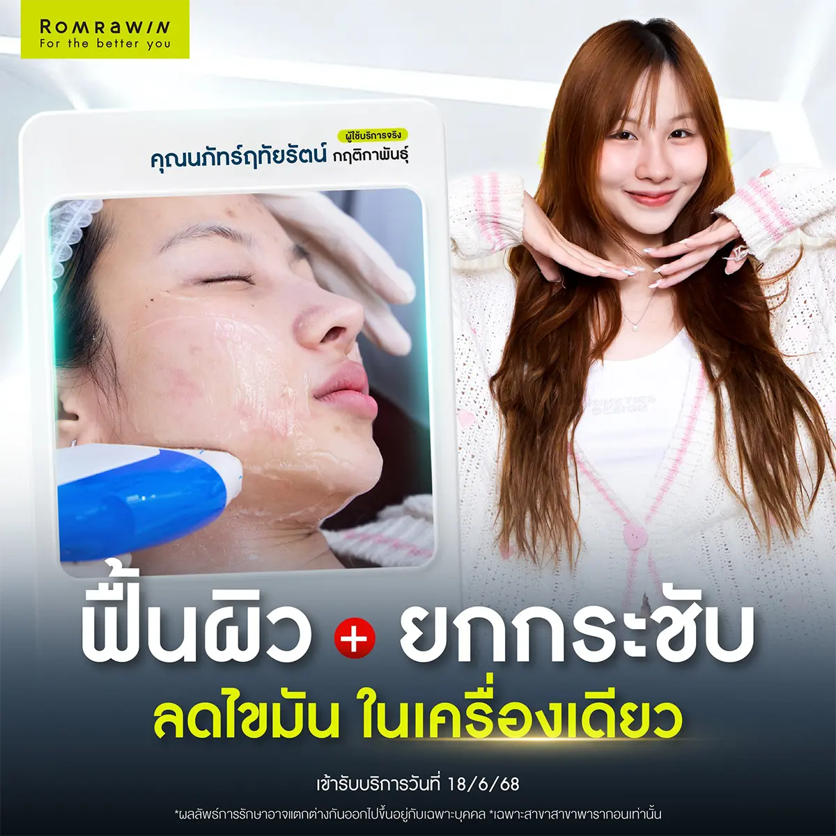 รีวิวยกกระชับผิวหน้า Romrawin Clinic