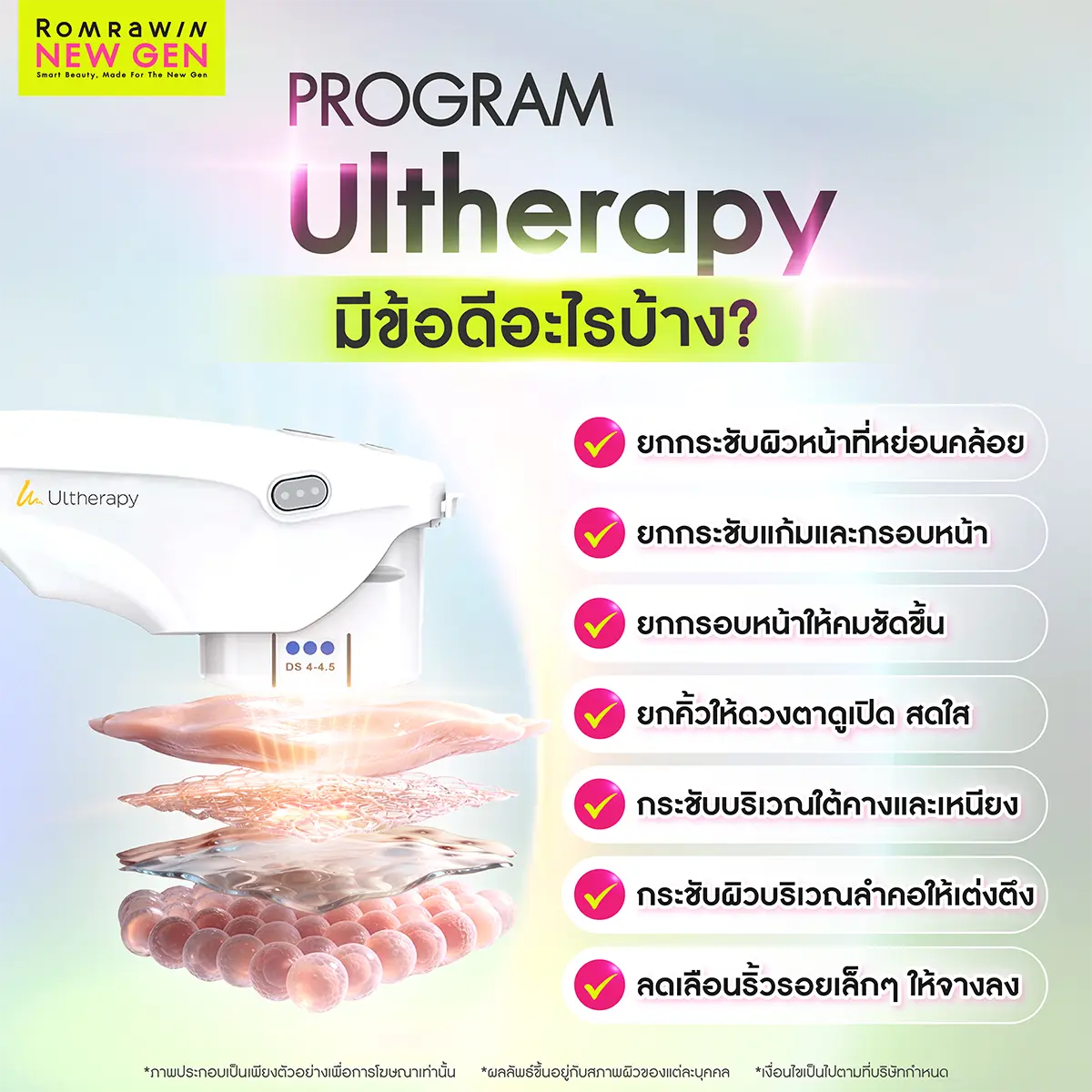 Ulthera มีข้อดีอะไรบ้าง