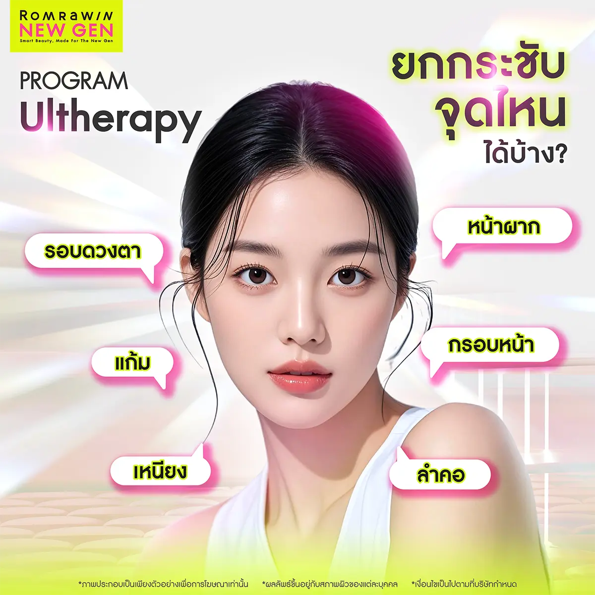 Ulthera ยกกระชับจุดไหนได้บ้าง