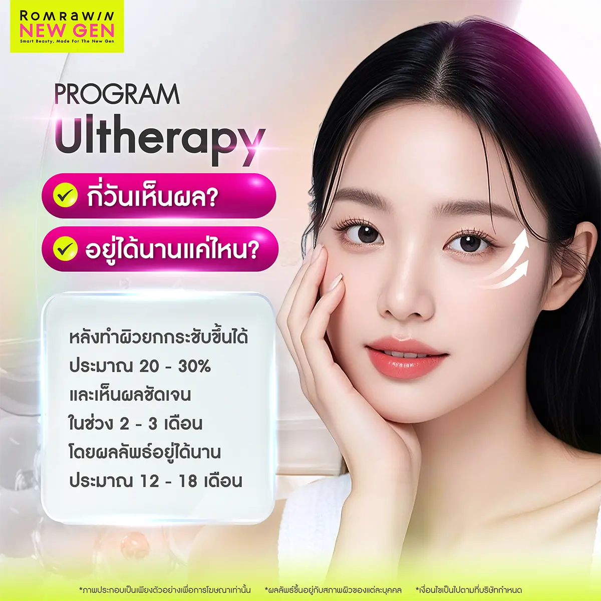 Ulthera กี่วันเห็นผล