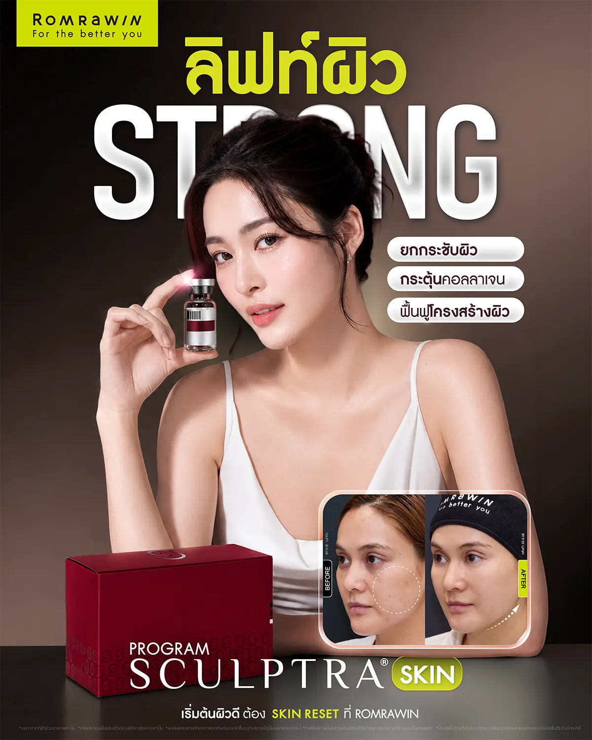 อินโฟกราฟิกโปรแกรม Sculptra Skin Romrawin แสดงภาพนางแบบถือขวดผลิตภัณฑ์พร้อมภาพเปรียบเทียบก่อนหลังทำรีวิวลิฟท์ผิวแก้ม