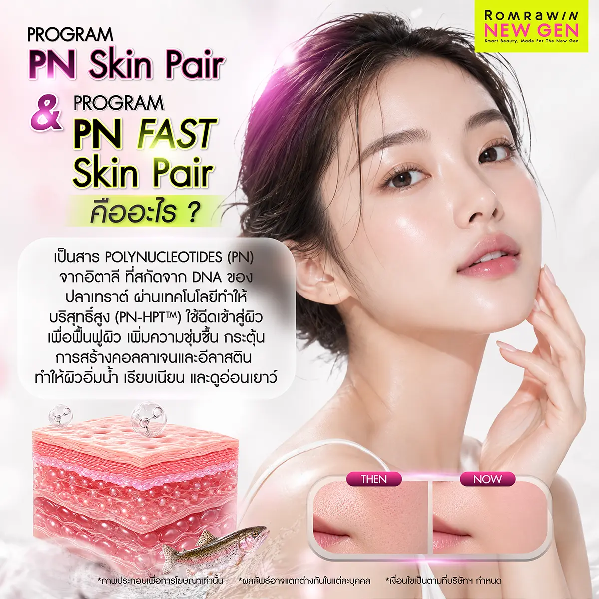 รีวิวโปรแกรม PN Skin หรือสารสกัดพอลินิวคลีโอไทด์สากล Plinest ตัวช่วยกู้ผิวพังชุ่มชื้นเรียบเนียนระดับเซลล์ของรมย์รวินท์คลินิก