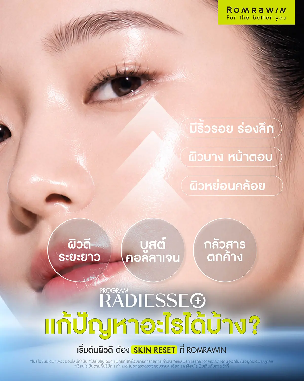 Radiesse ตัวช่วยกู้ผิวพังจัดการปัญหาร่องลึกและผิวหย่อนคล้อยที่รมย์รวินท์คลินิก