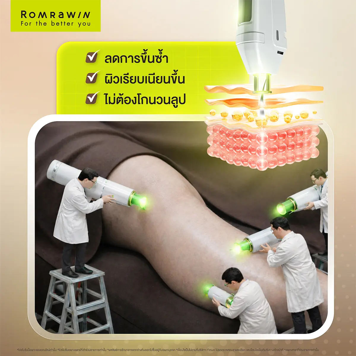 ภาพกราฟิกโปรแกรมกำจัดขนขารมย์รวินท์คลินิกโชว์ลิสต์จุดเด่นสามข้อคู่กับโมเดลจำลองการทำงานฝั่งรากขน