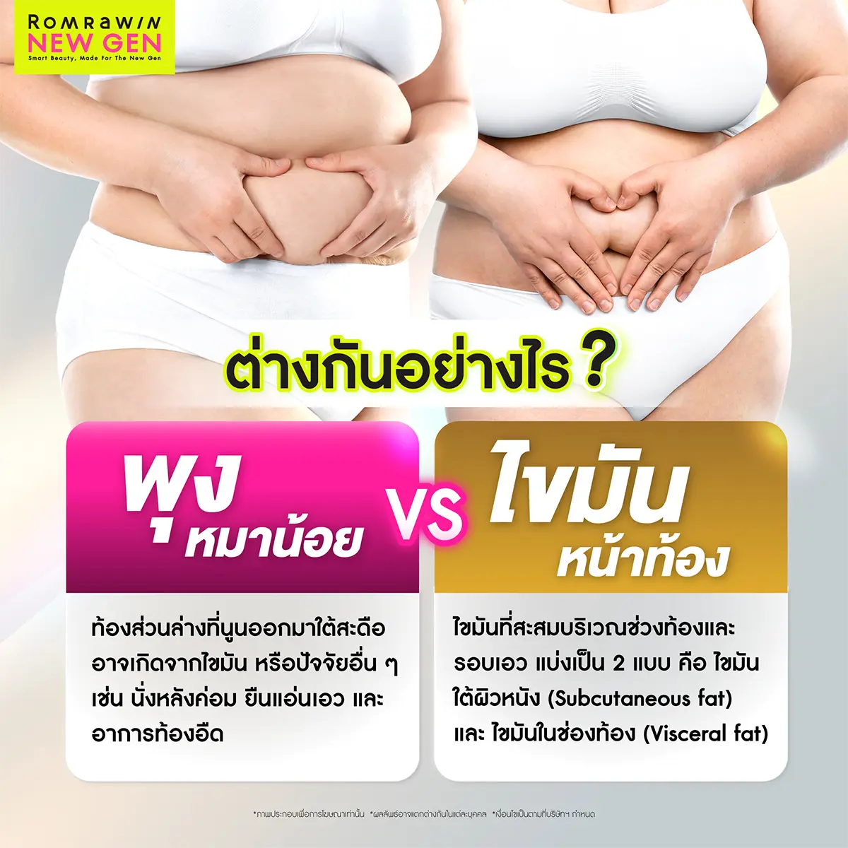 ต่างกันอย่างไร พุงหมาน้อย VS ไขมันหน้าท้อง ภาพเปรียบเทียบลักษณะไขมันสะสมรอบเอว