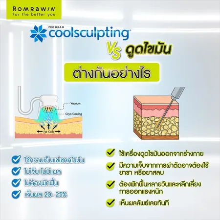 Coolsculpting สลายไขมันด้วยความเย็น